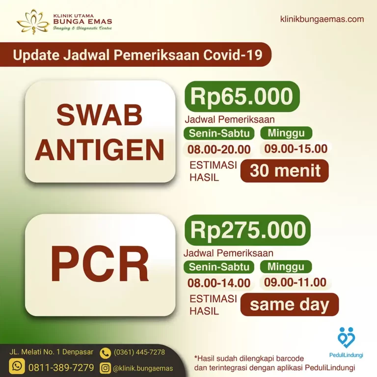 update jadwal tes covid19 antigen dan pcr di denpasar