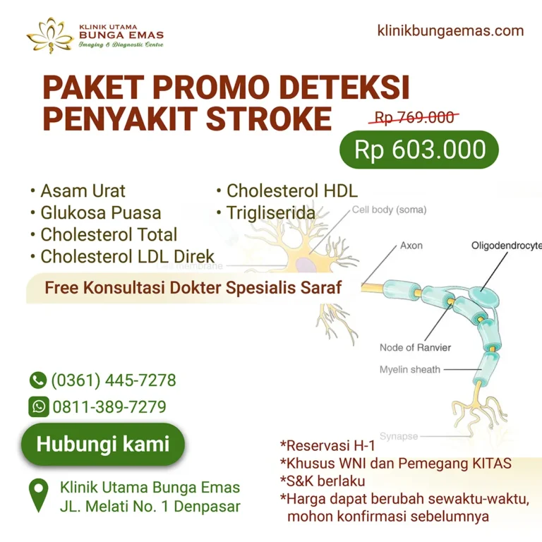 PROMO PAKET DETEKSI RESIKO PENYAKIT STROKE 2025 di bali