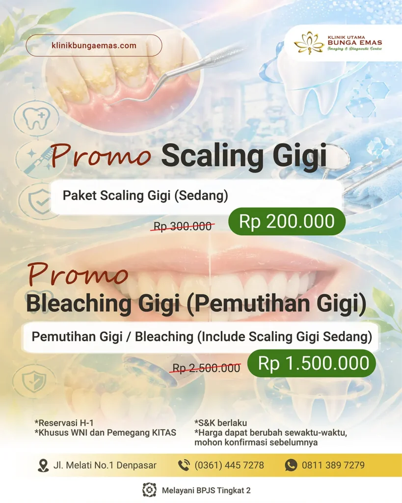 Promo Scaling Gigi dan Bleaching Gigi 2026