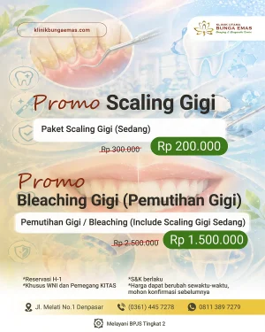 Promo Scaling Gigi