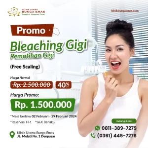 Promo Bleaching Gigi